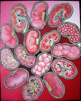 Zeitgenössisches Werk mit dem Titel « Spirale nephropatique », Erstellt von CHLOé YZOARD