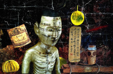 acupuncture-chinoise